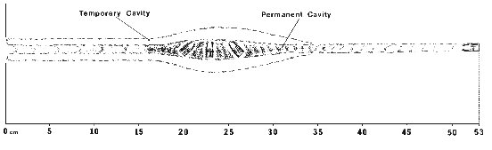 38 / 45 RN Wound profile (15k jpg)